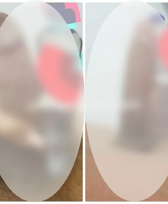 Foto di 3924908500
