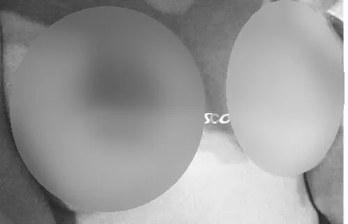 Foto di 3533904152