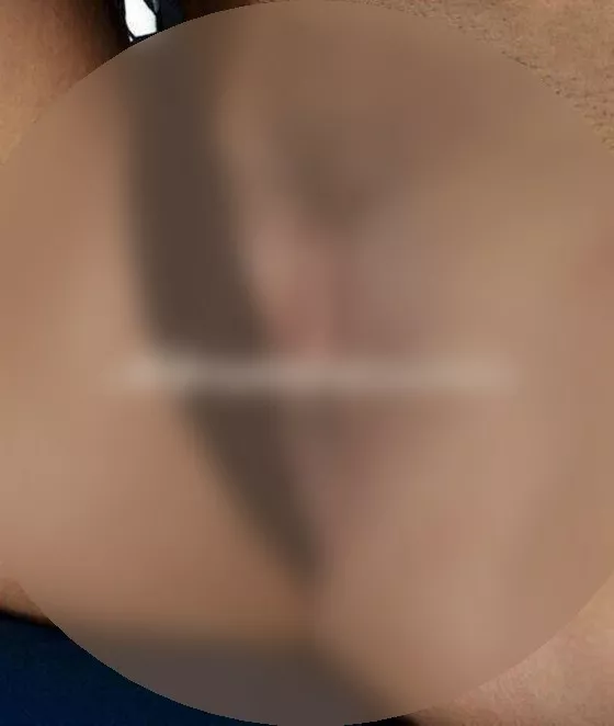 Foto di 3485742323