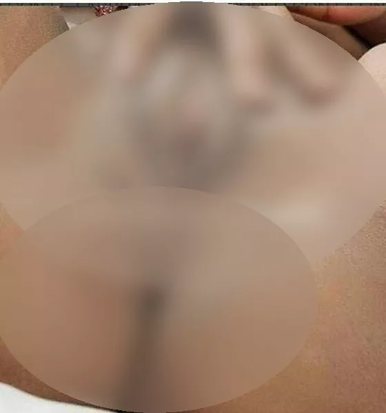 Foto di 3515794386