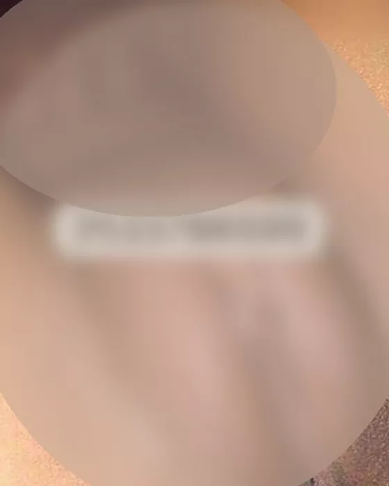 Foto di 3533786599