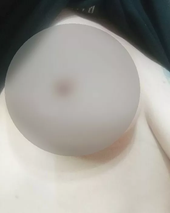 Foto di 3533857410