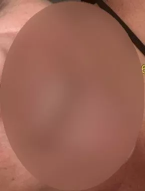 Foto di 3934563200