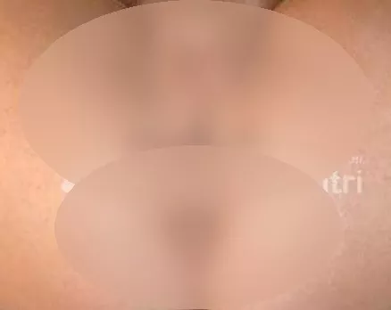 Foto di 3511061937