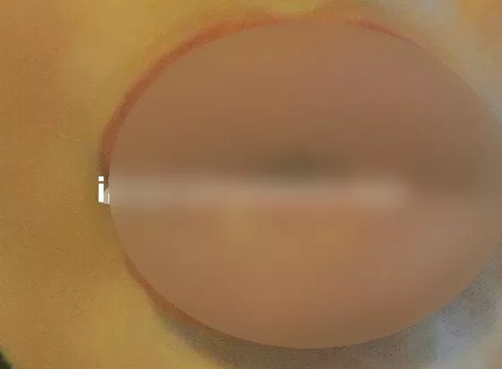 Foto di 3520818078