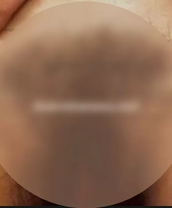 Foto di 3717851395