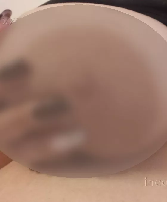 Foto di 3514590556