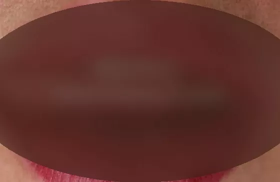 Foto di 3491377702