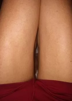 Foto di 3493743883
