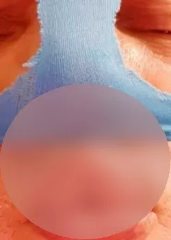 escort.it - Amputesex...