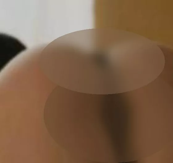Foto di 3314306692