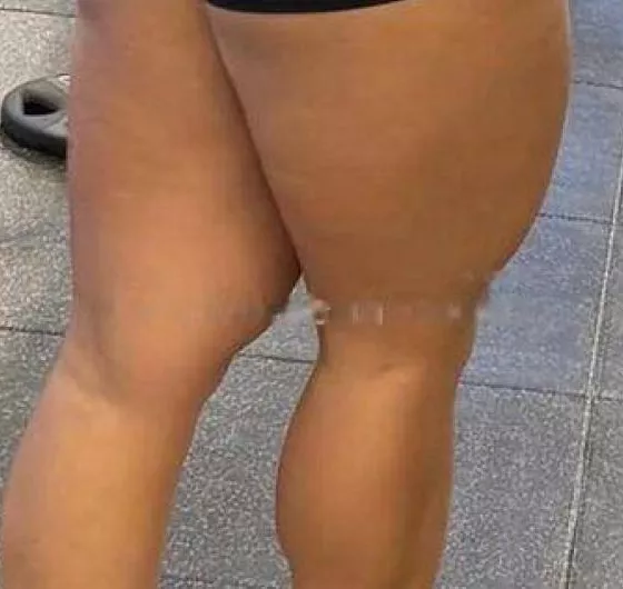 Foto di 3509108892