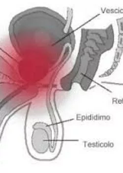 escort.it - i benefici della stimolazione alla ghiandola prostatica ......aiuta a ridurre i problemi che derivano dall'ingrossamento della p