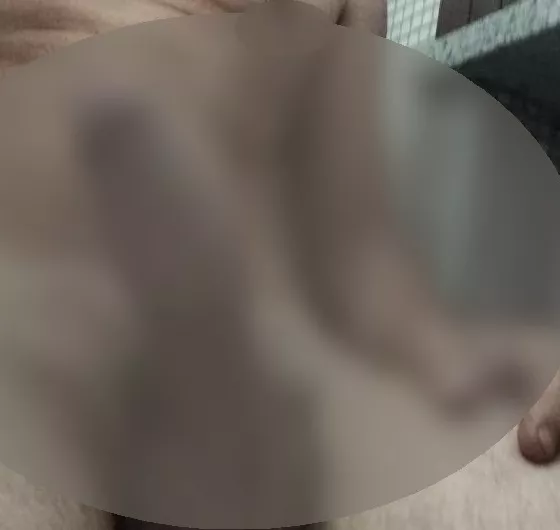 Foto di 3920640466
