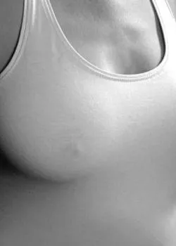 Foto di 3409333667