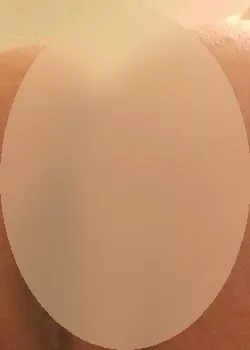 Foto di 3491307630