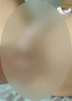 Foto di 3318069862