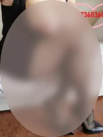 Foto di 3336836850