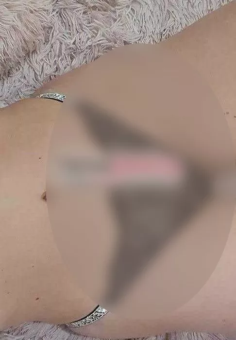 Foto di 3477166608